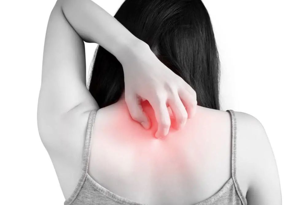 肿瘤科医生提醒皮肤瘙痒要警惕这5种癌症转发收藏