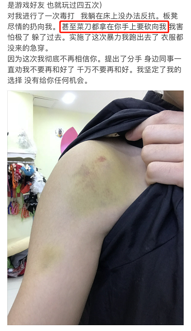 曝23岁歌手私生活混乱被女友指控家暴出轨还动刀本人退赛回应