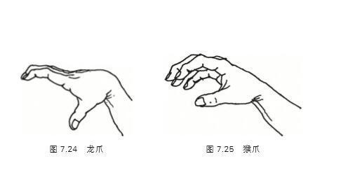 龙爪手形图解图片