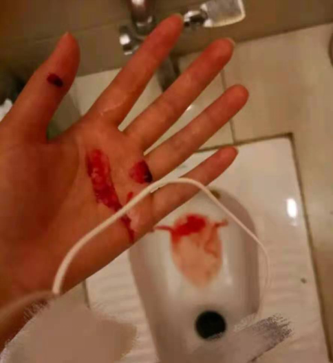 意问我是不是经常浑身没劲儿还心慌,我没敢承认;近几个月我经常流鼻血