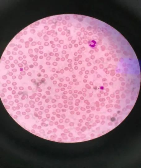 血小板跌宕起伏,缘何起?