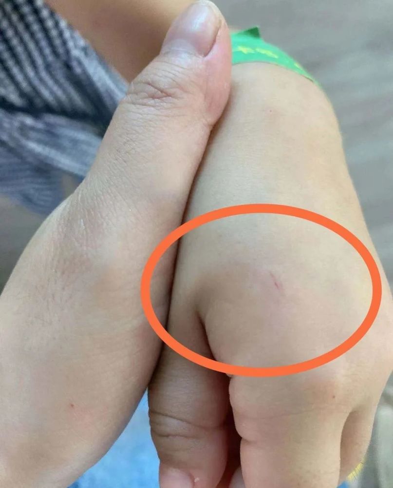 孩子的手被兔子咬破了皮姚女士:萌宠店的主要受众是小孩子,店家