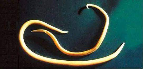 2米寄生虫来袭!非洲350万人困扰多年的寄生虫,原因竟然是这些