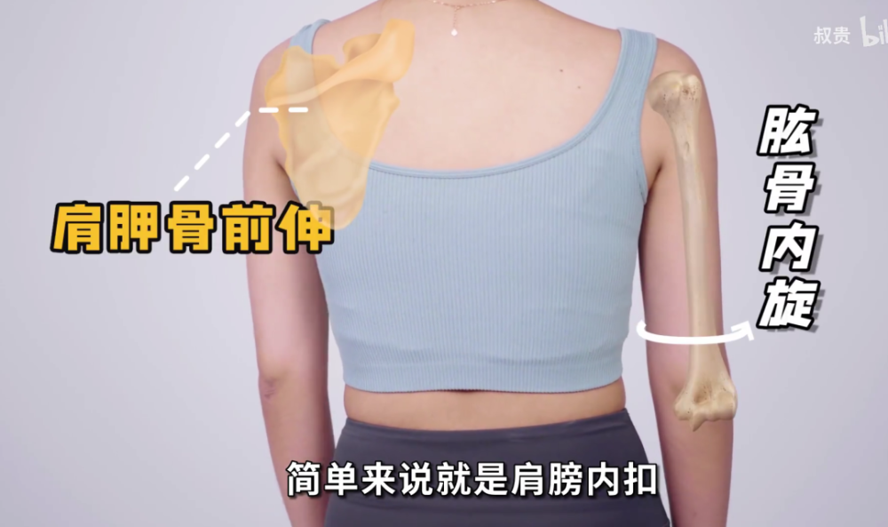 首先,背从后面看着宽,有可能是肩胛骨前伸   肱骨内旋.