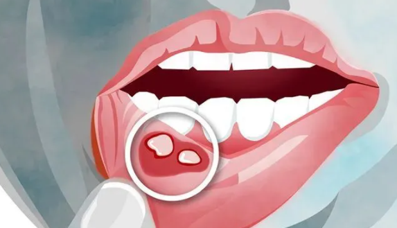 去土耳其千万别带槟榔已有多名中国公民因它被捕