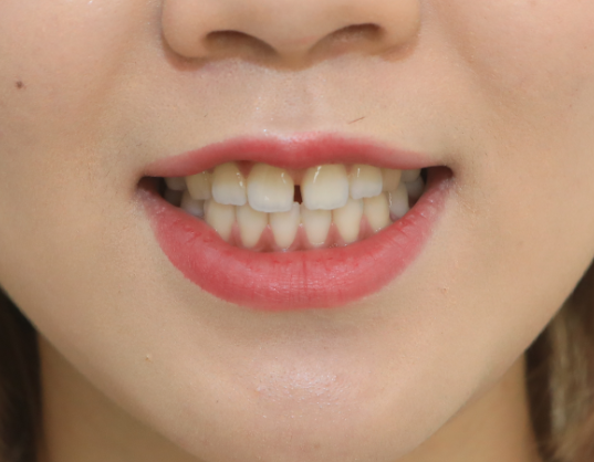 有同款牙缝吗太社死了