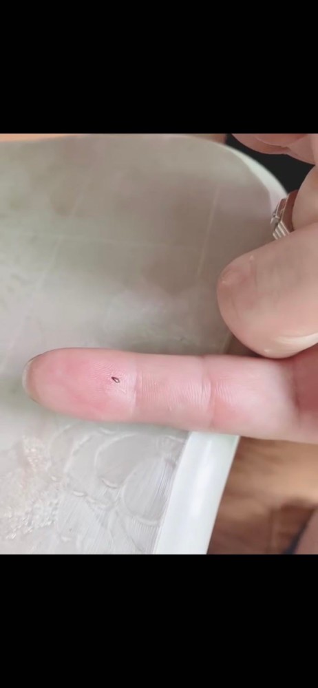 成都一业主喂养流浪猫狗导致小区出现跳蚤 双流公安分局,东升街道调查