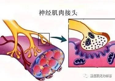 首先說全身型重症肌無力,重症肌無力是人類疾病中病因研究最清楚,也是