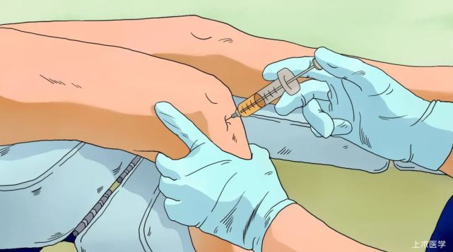 膝关节|打封闭|骨关节炎|玻璃酸钠|膝盖