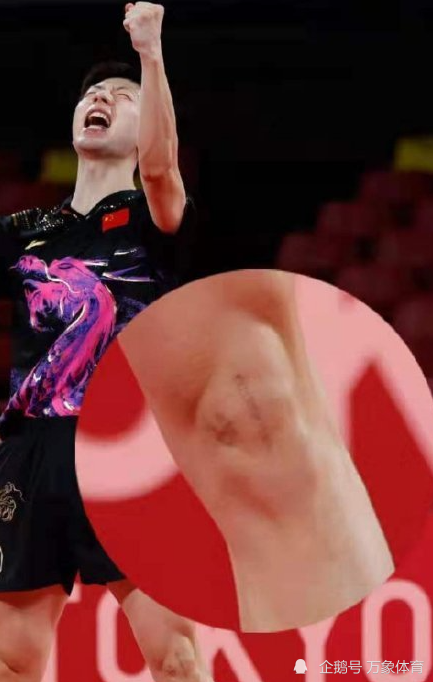 33岁马龙夺冠有多难?膝盖伤疤显眼,又深又长,2年仍清晰可见