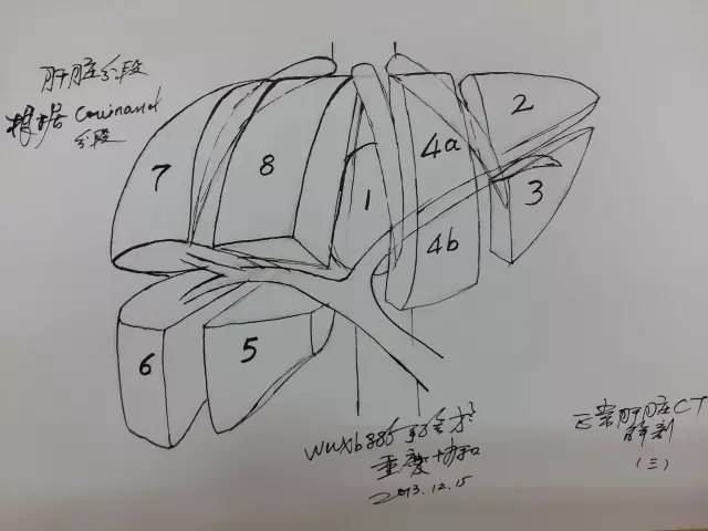 点击查看:手绘37幅肝脏ct解剖图,哪个医生这么牛