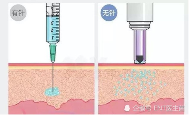 我国儿童药物将无针注射!生长激素首先获批