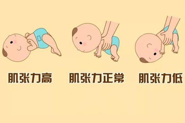 别让"肌张力"毁了宝宝!