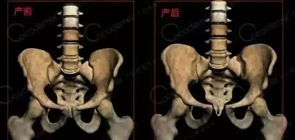 生产前后骨盆的变化 怀孕4周后,身体开始分泌可以使韧带松弛的荷尔蒙