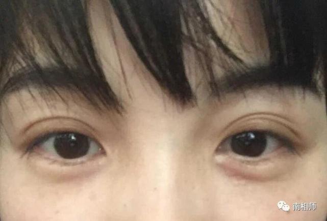 桃花运|额头|面相|婚姻|三白眼|夫妻宫|克夫|眉毛|奸门