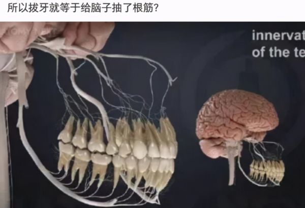 【沙雕问题3】:请问一下兄弟们!拔牙就等于给脑子抽了一根筋?