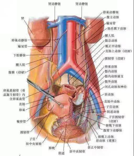 什么是盆腔动静脉畸形?如何诊断?怎么治疗?