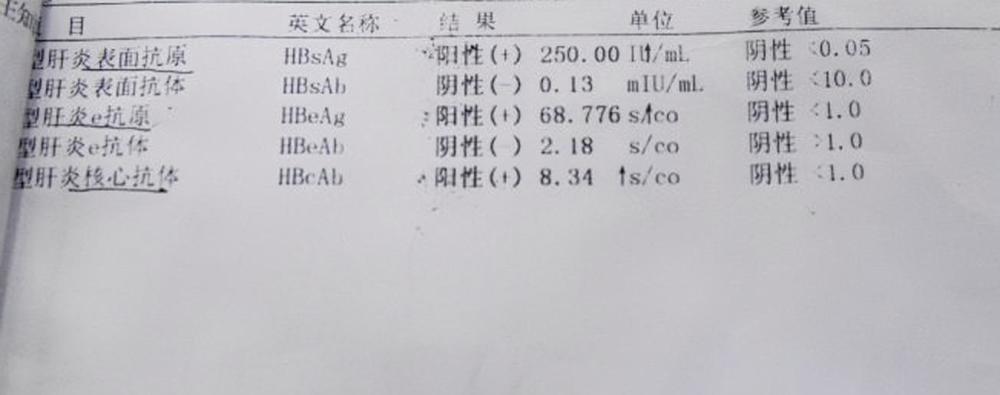 治療乙肝為什麼希望大三陽轉為小三陽小三陽比大三陽嚴重嗎