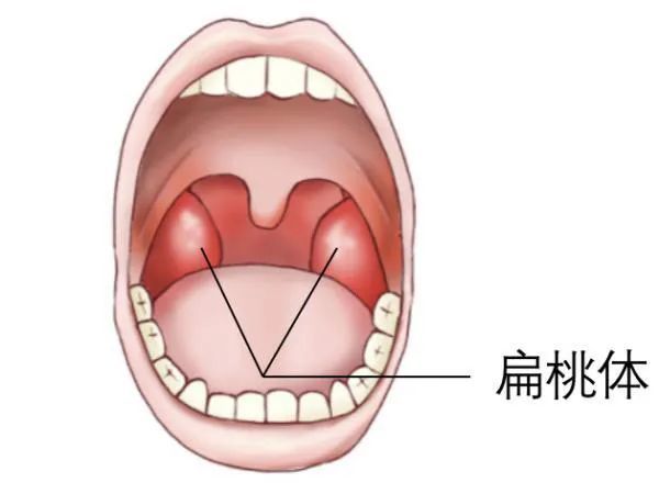 咽扁桃体位置图解图片