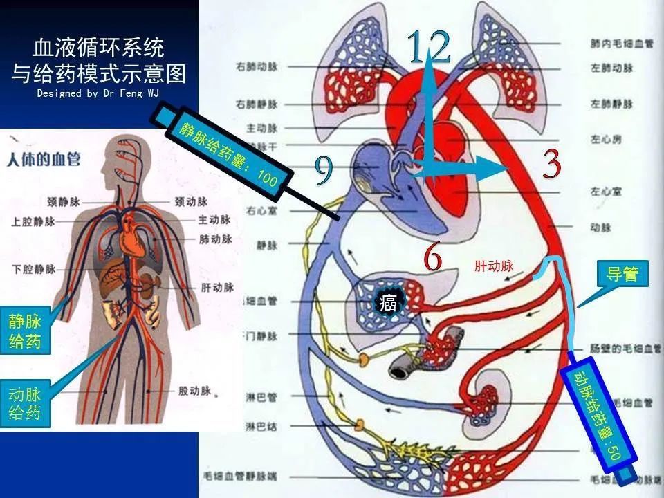 动脉树状图图片