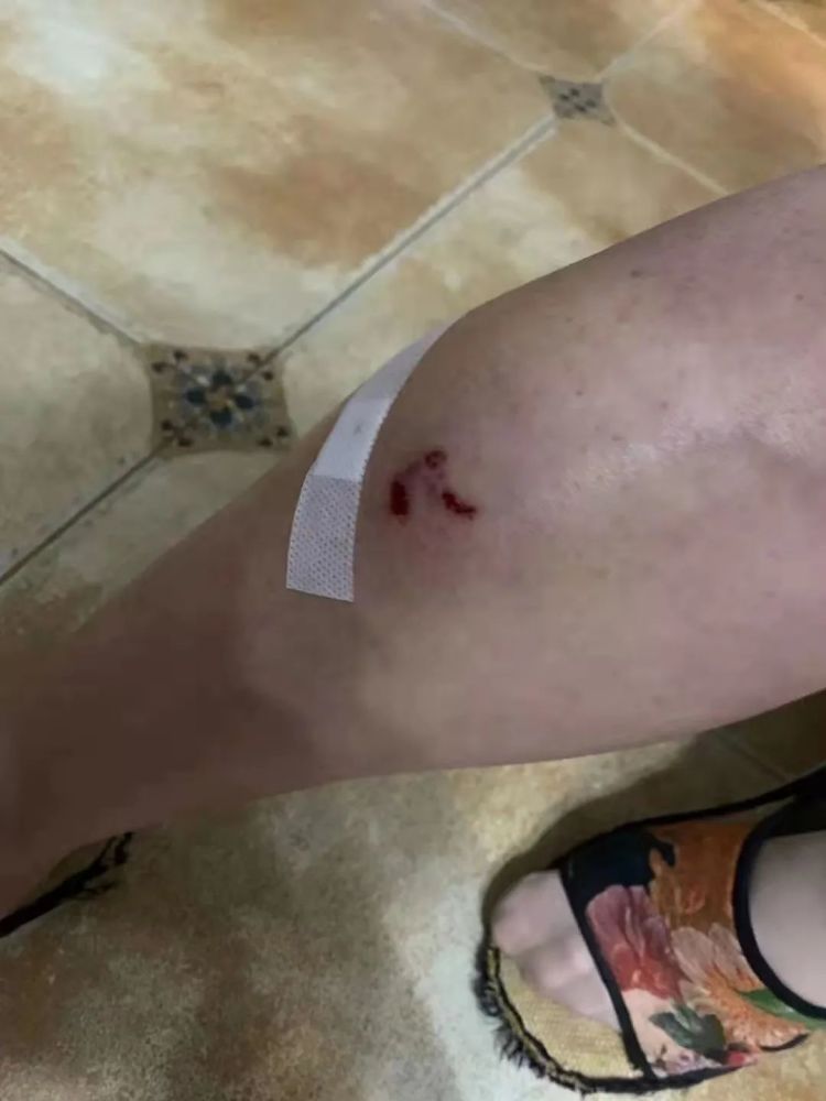 邻居被狗咬伤男子赔钱后发现不对劲