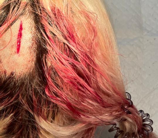 女网红遭运动员男友家暴致头破血流,警方通报:以寻衅滋事罪拘留罚款