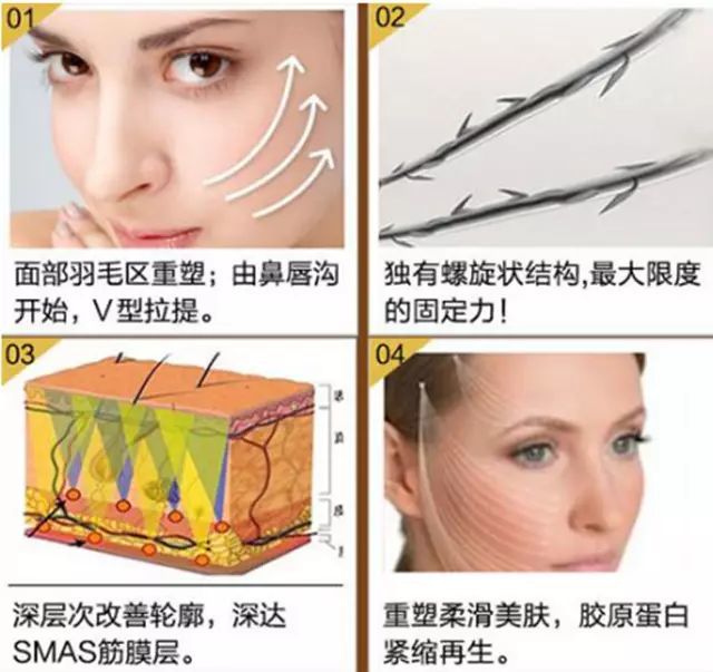 线雕的神奇之美—埋下1根线,逆龄少女脸