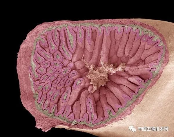 小肠绒毛是排列在小肠内部的绒毛状结构(见下图)