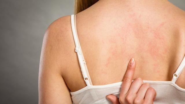 肝内毒素多,身体或会出现4个异常,若没有肝脏或还算健康