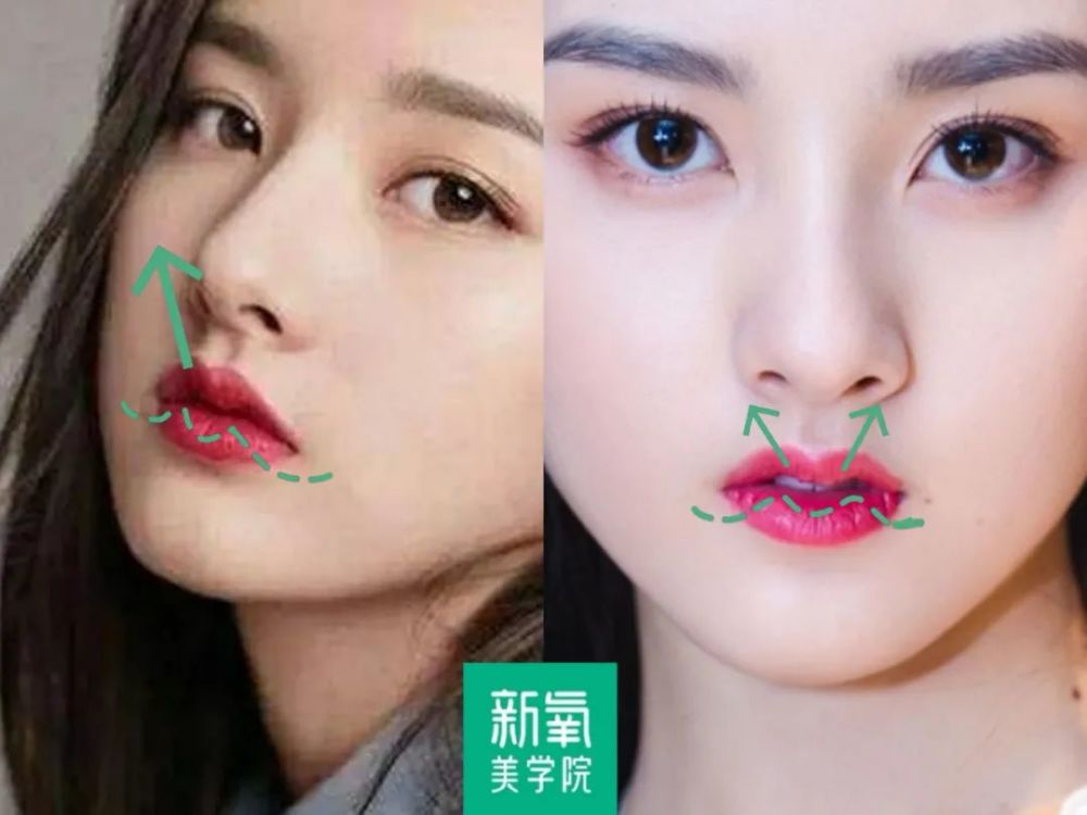 宋祖儿的嘴唇就是典型的向上走势的m唇形,上唇两侧肌肉下压,突出唇线