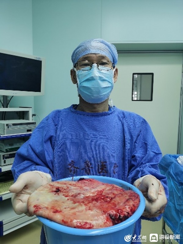 直径近50cm巨大肿瘤山东大学齐鲁医院多学科联合成功救治