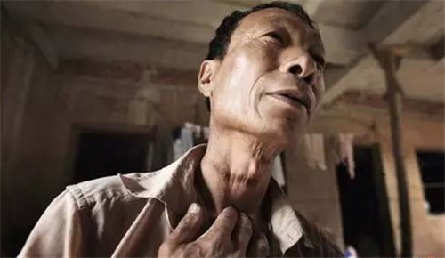 云南食人魔张永明7年内杀害11位少年把肉当作鸵鸟肉卖掉