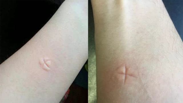 花蚊子来到中国不到50年,但人们已无法乘凉,它是何方神圣?