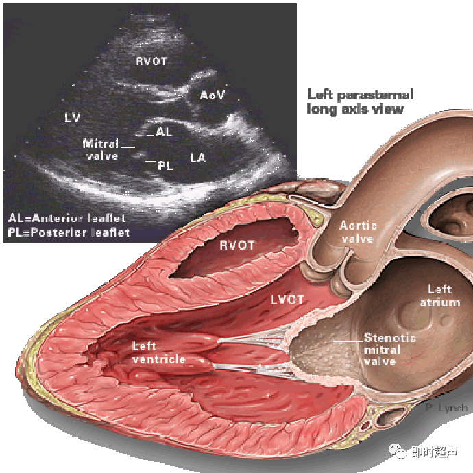 心臟瓣膜病超聲診斷_騰訊新聞