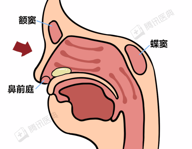 耳鼻咽喉头颈外科|鼻腔|鼻窦炎|过敏性鼻炎|腾讯医典
