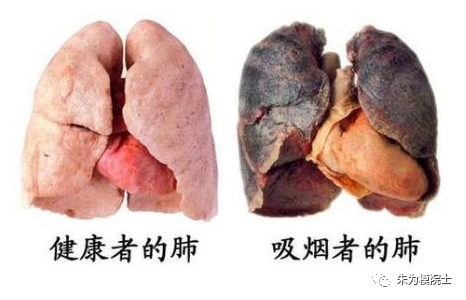 肺气肿能活多久图片