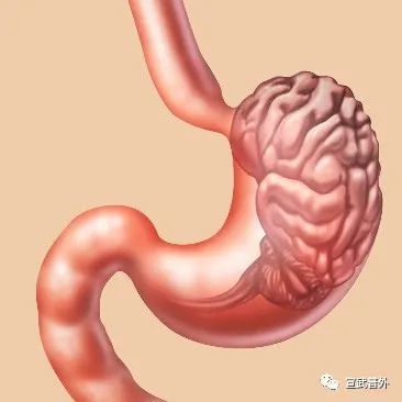 胃胀位置图片图片