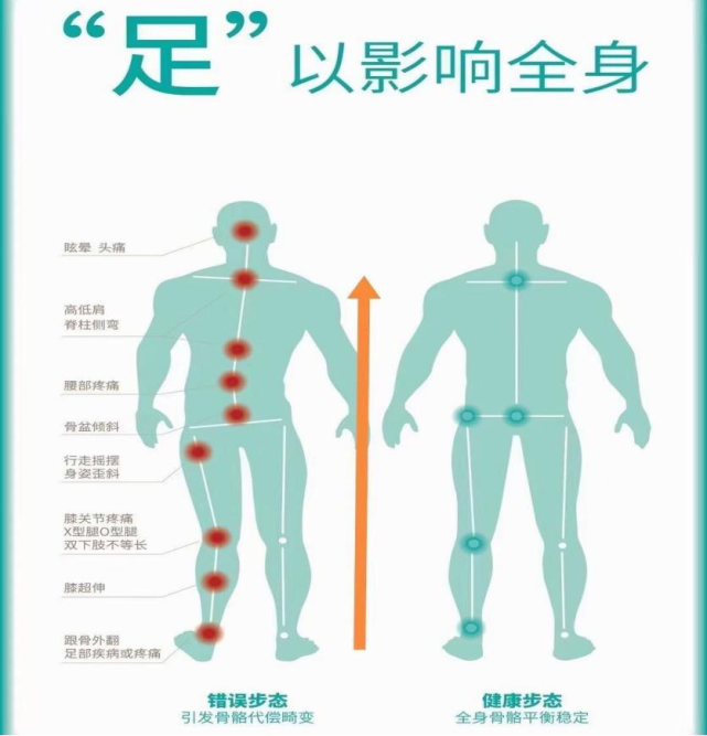 孩子走不远,跳不高,跑不快,小心步态异常!