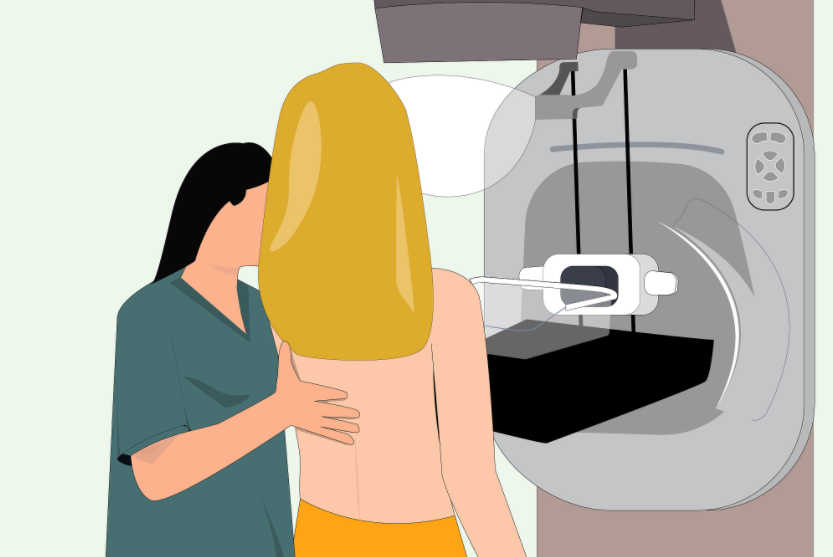 我们请北京市隆福医院放射科医师卢守彬,吴俊讲讲乳腺钼靶是什么检查