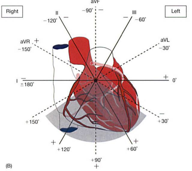 心电向量图检查意义图片