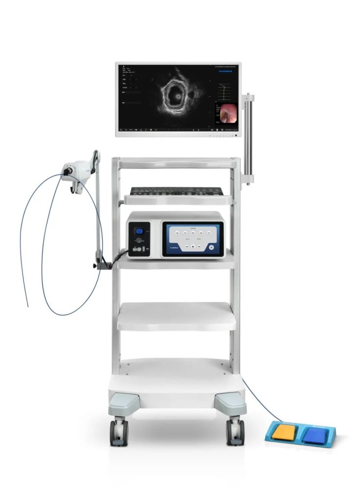 国产微型化探头超声内镜来了_腾讯新闻