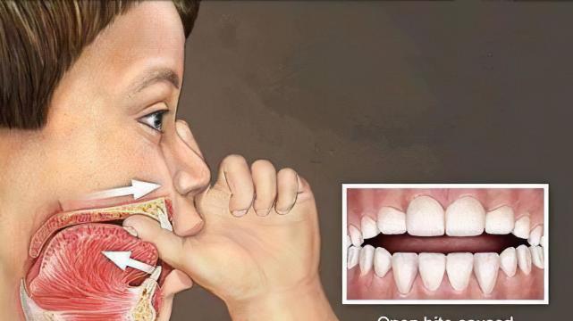 宝宝"吃手"变聪明还是变丑,到底要不要阻止?父母千万别做错了