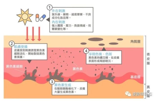 皮秒镭射除斑后,如何长久护肤不长斑?