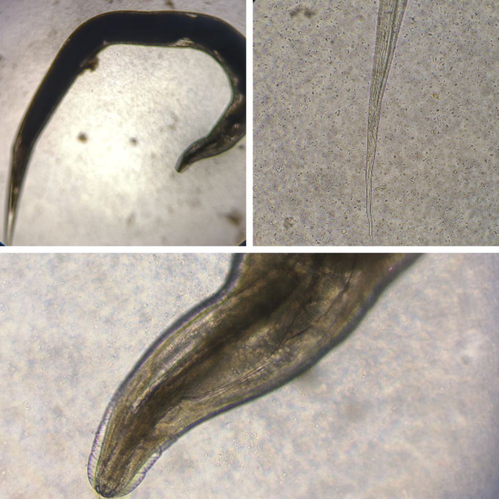 简便快捷诊断蛲虫感染这个方法你试过么