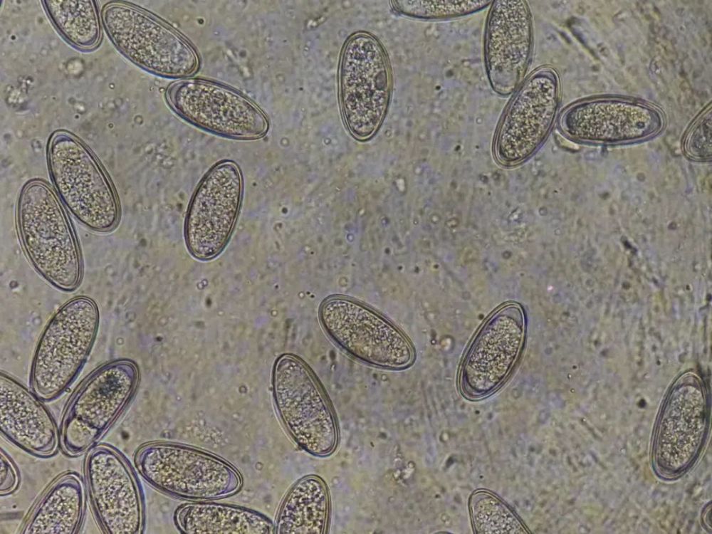 将蛲虫用细针切成两段,虫体里的虫卵一拥而散,场面甚是壮观,见图3.