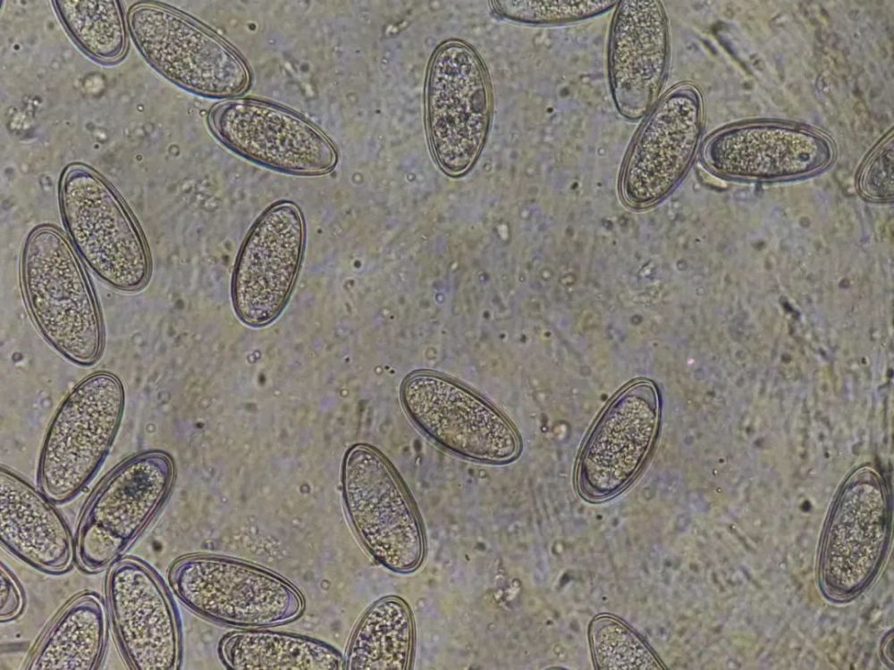 饶虫卵显微镜下图片图片