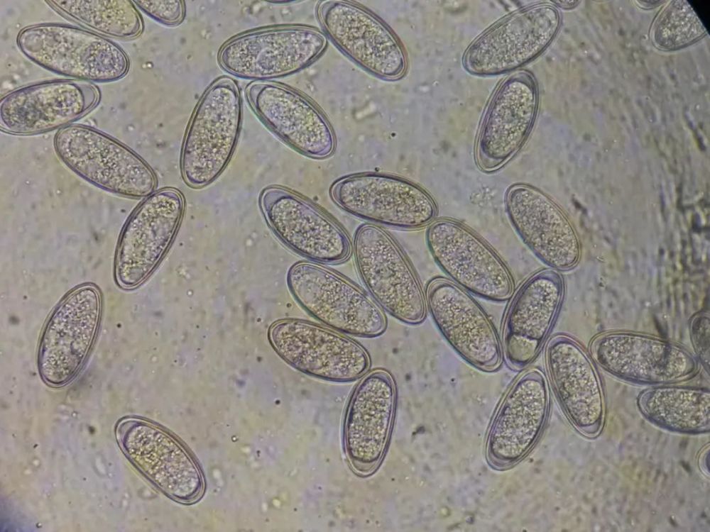 将蛲虫用细针切成两段,虫体里的虫卵一拥而散,场面甚是壮观,见图3.