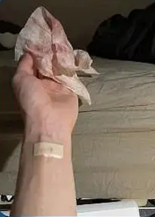 纱布,看起来出血量还不小,但她似乎并未好好处理伤口,只是在手腕处
