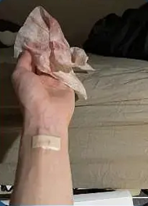 她手里抓着一把带血的纱布,看起来出血量还不小,但她似乎并未好好处理