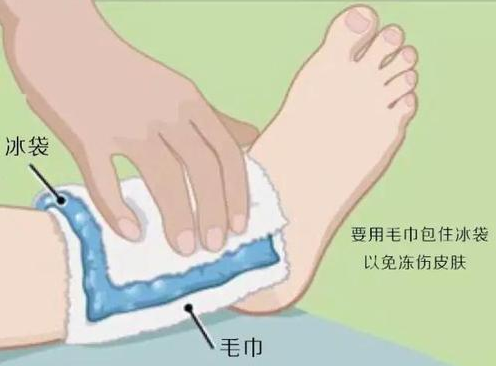 但是冰敷并不能长期使用,因为冰敷太久,反而可能有冻伤的风险.